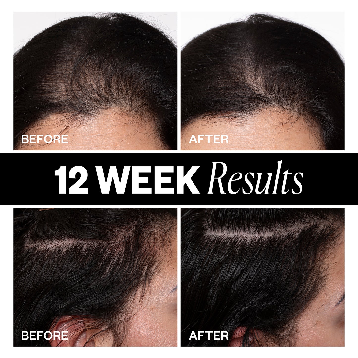Sponsored High Density Scalp Treatment
