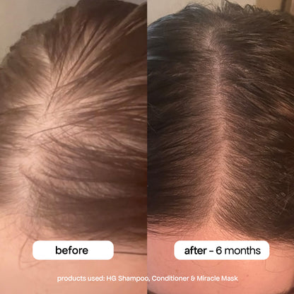 Growth Miracle Mask