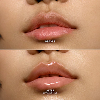 Lip Treatment Balm