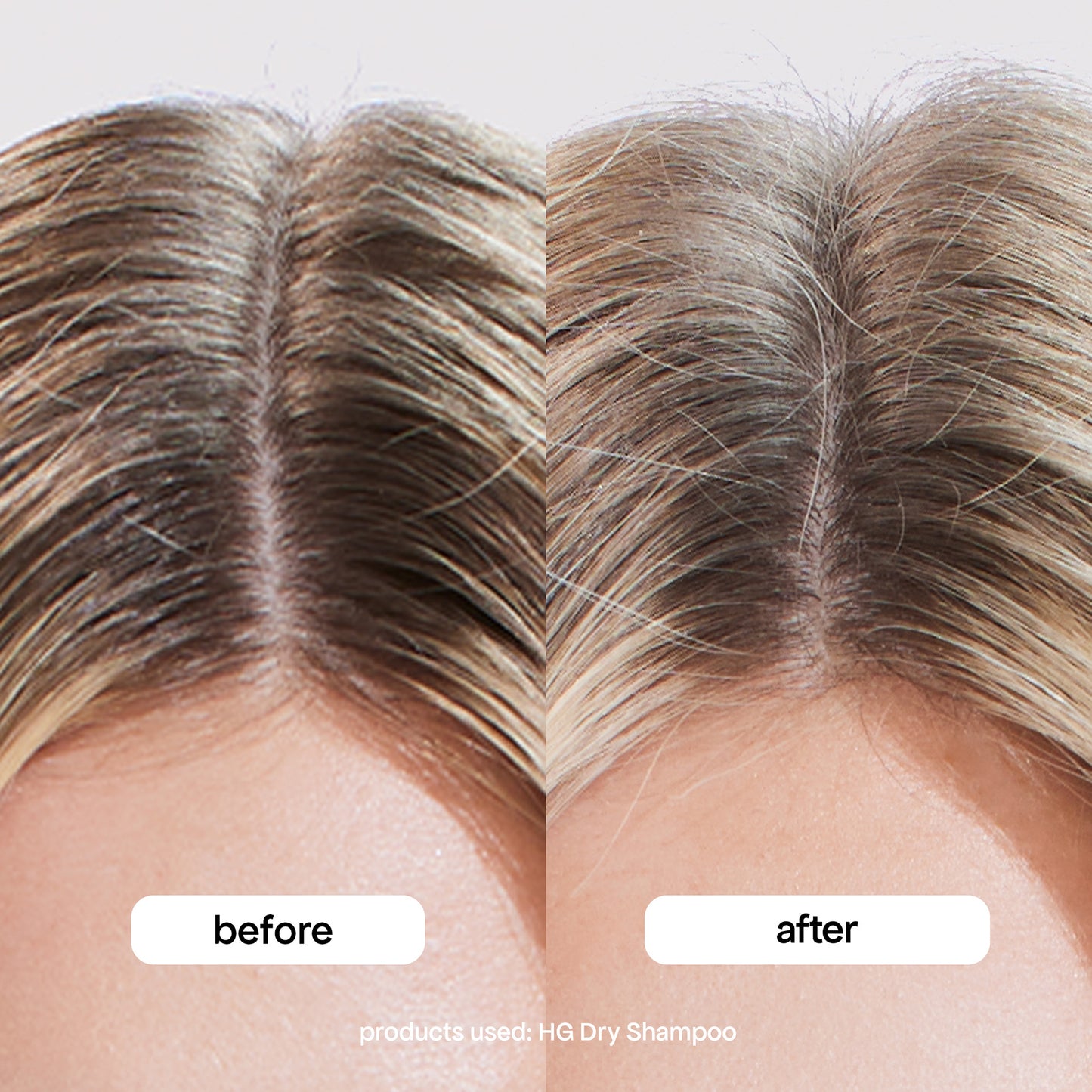 Hg Dry Shampoo