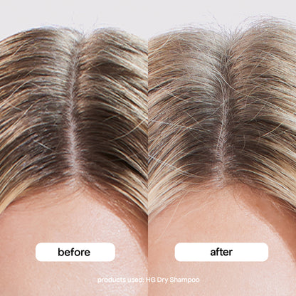 Hg Dry Shampoo