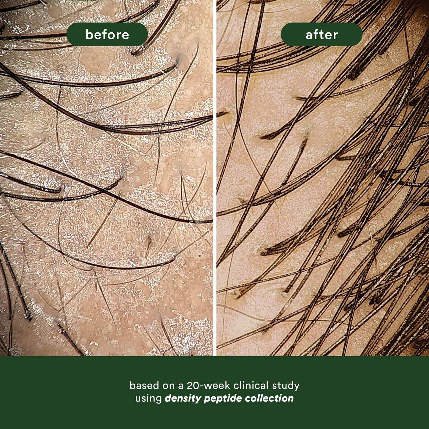 Hair Density Peptide Shampoo