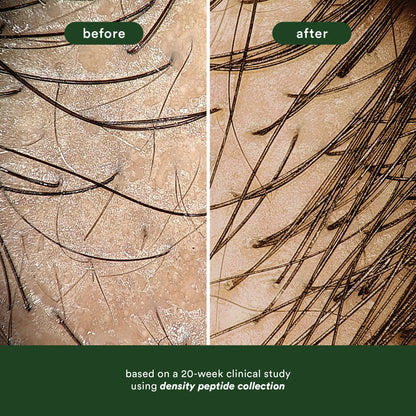 Hair Density Peptide Shampoo