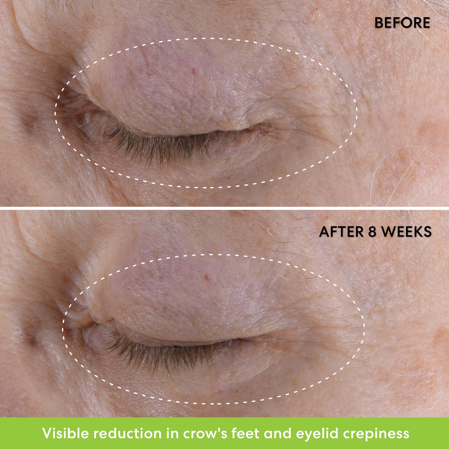 Ageless Phyto-retinol Eye Cream