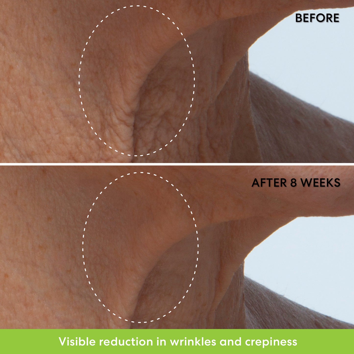 Ageless Phyto-retinol Neck Cream