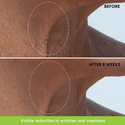 Ageless Phyto-retinol Neck Cream