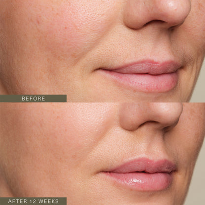 Firming Plant Peptide Serum