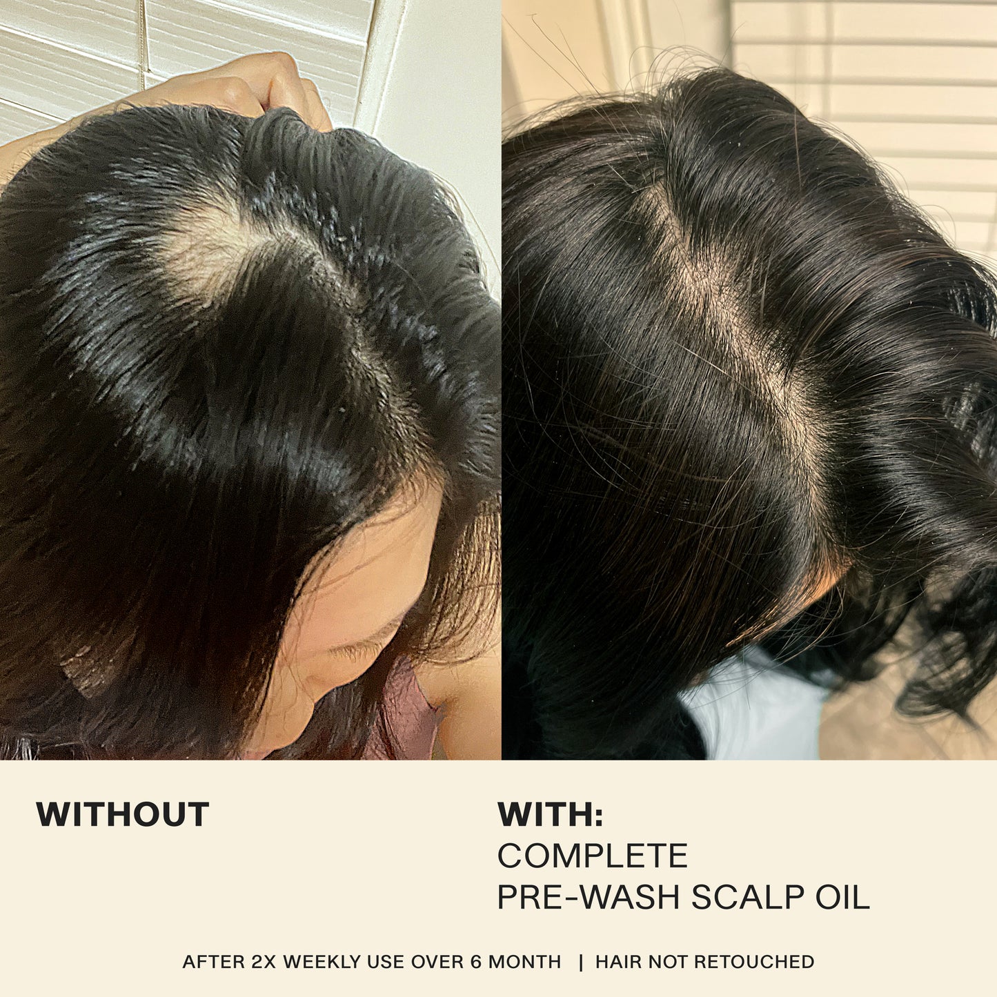 Complete Pre-Wash Scalp Oil