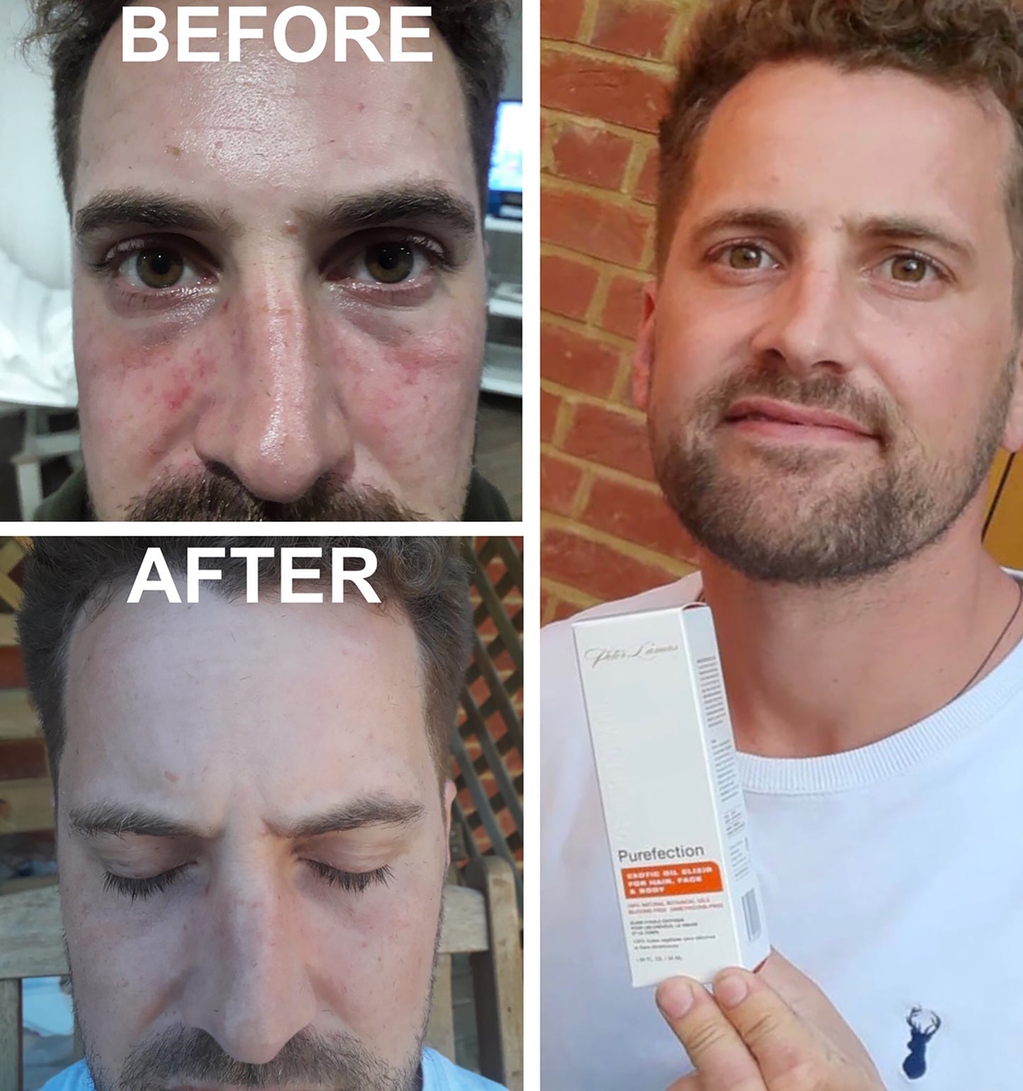 Purefection, Exotic Oil Elixir (for Hair, Scalp Face & Body)