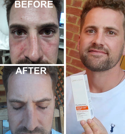 Purefection, Exotic Oil Elixir (for Hair, Scalp Face & Body)