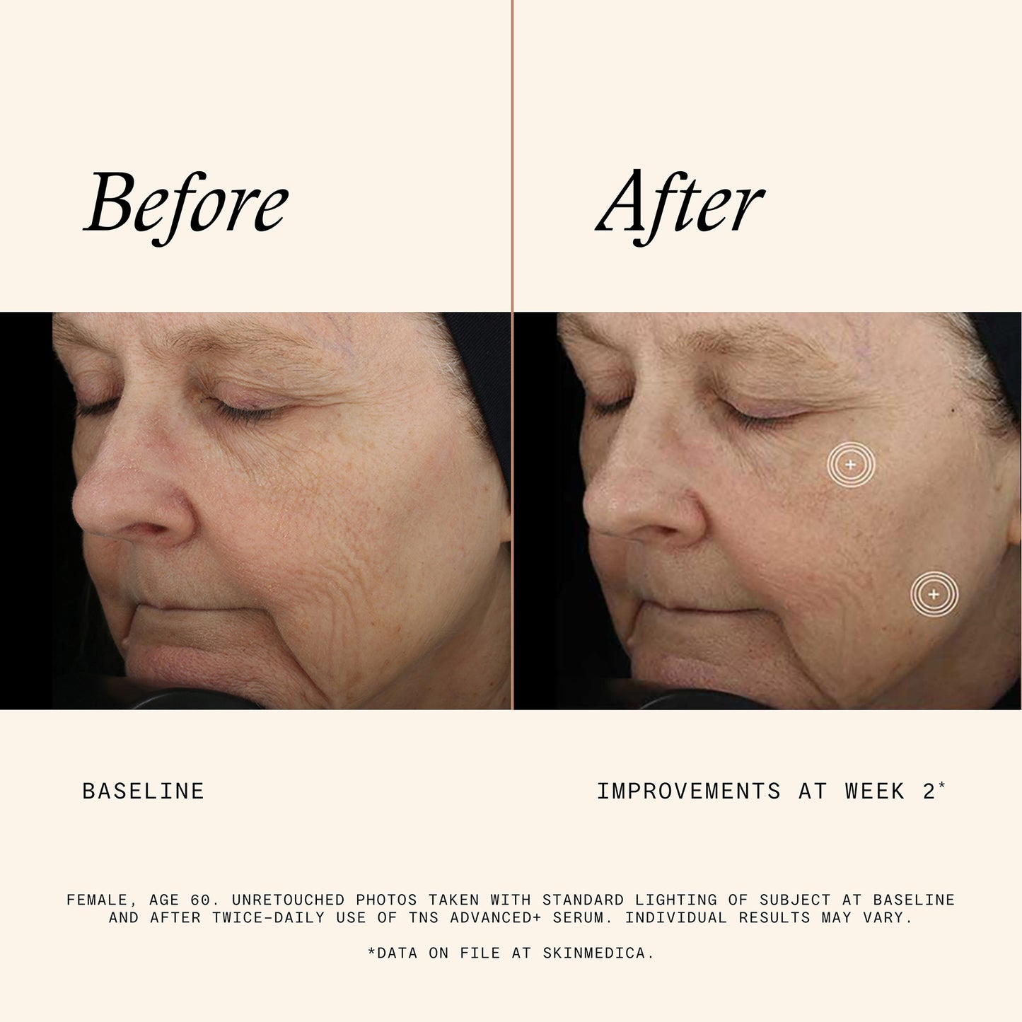 Tns Advanced Plus Serum