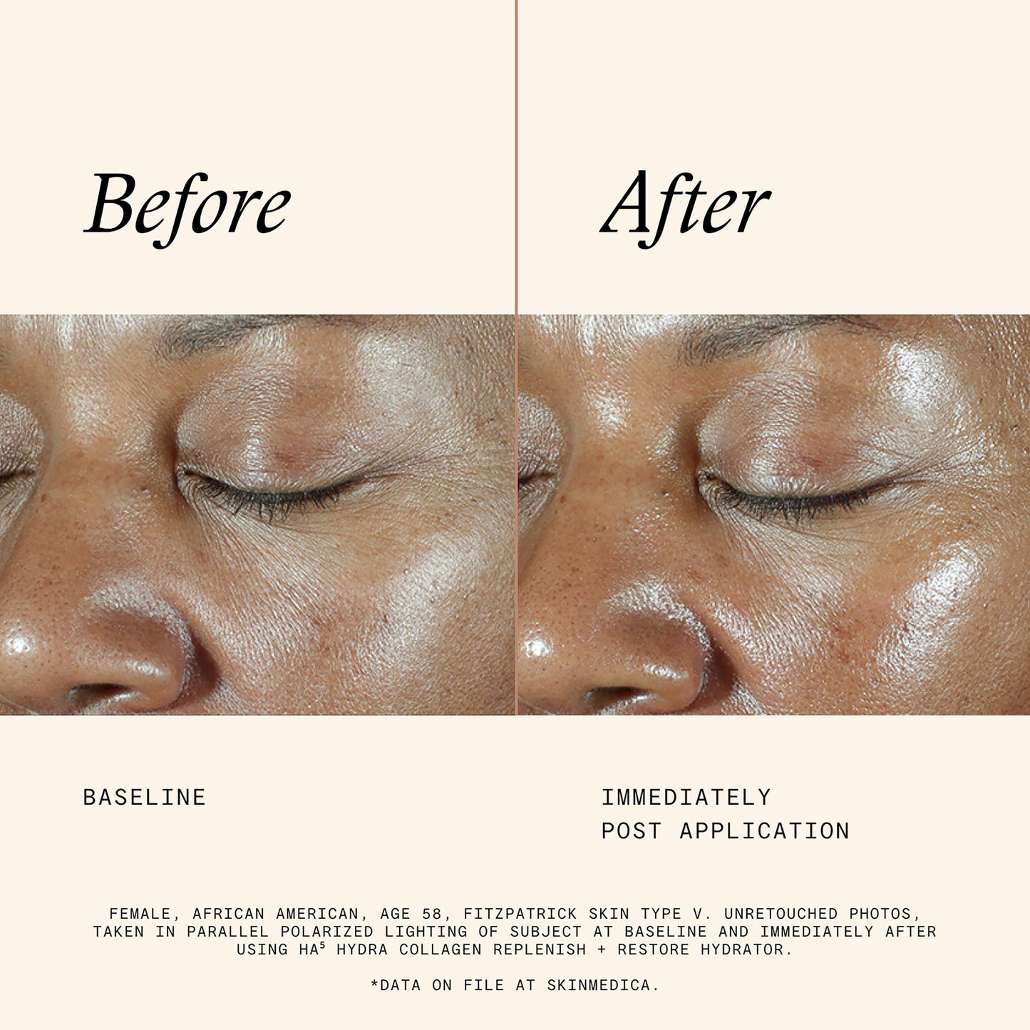 Ha5 Hydra Collagen