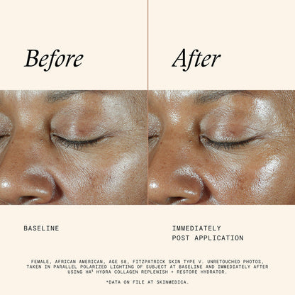 Ha5 Hydra Collagen
