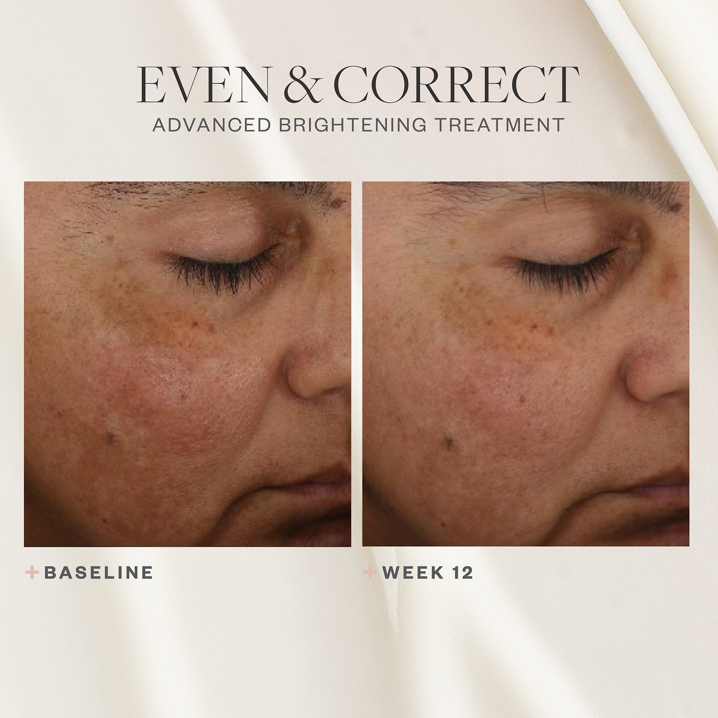 Even & Correct Advanced Brightening Treatment
