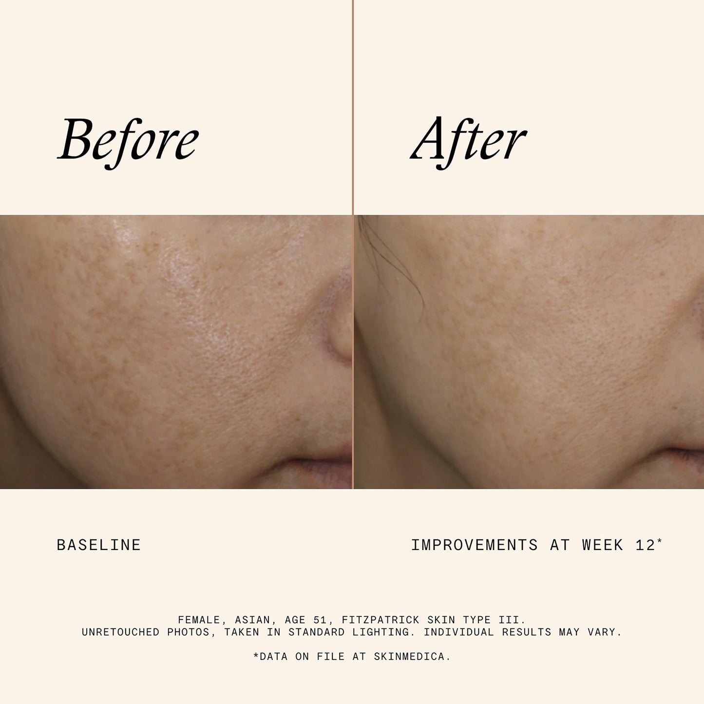 Even & Correct Advanced Brightening Treatment