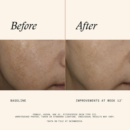 Even & Correct Advanced Brightening Treatment