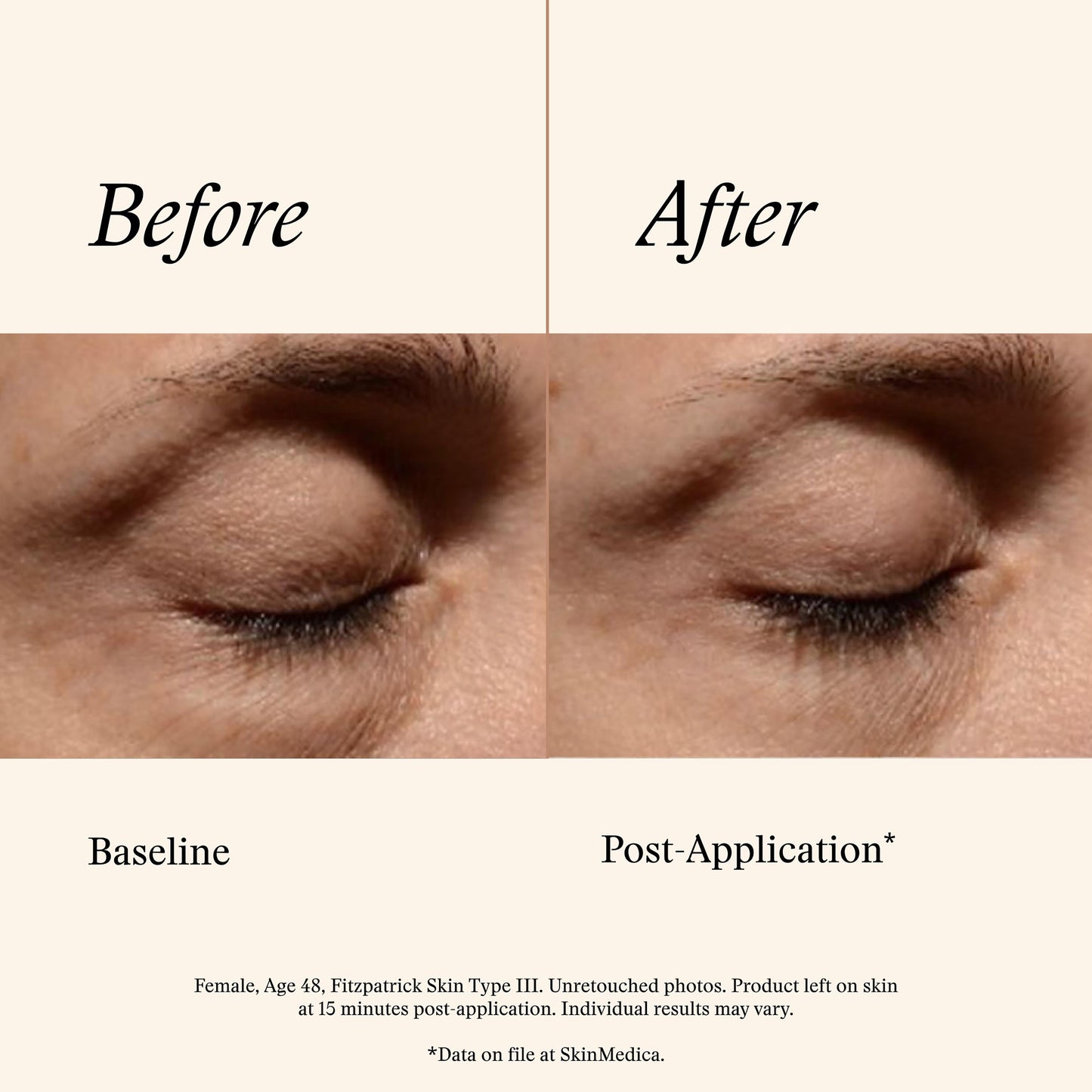 Instant Bright Eye Cream