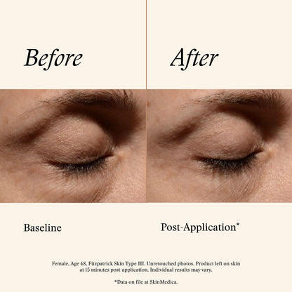 Instant Bright Eye Cream