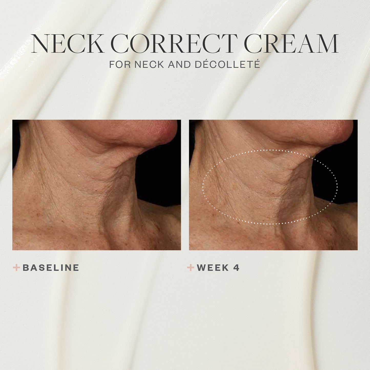 Neck Correct Cream