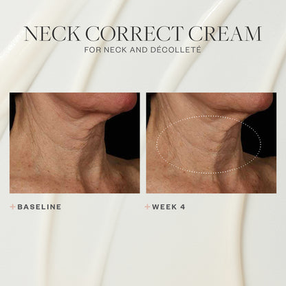 Neck Correct Cream