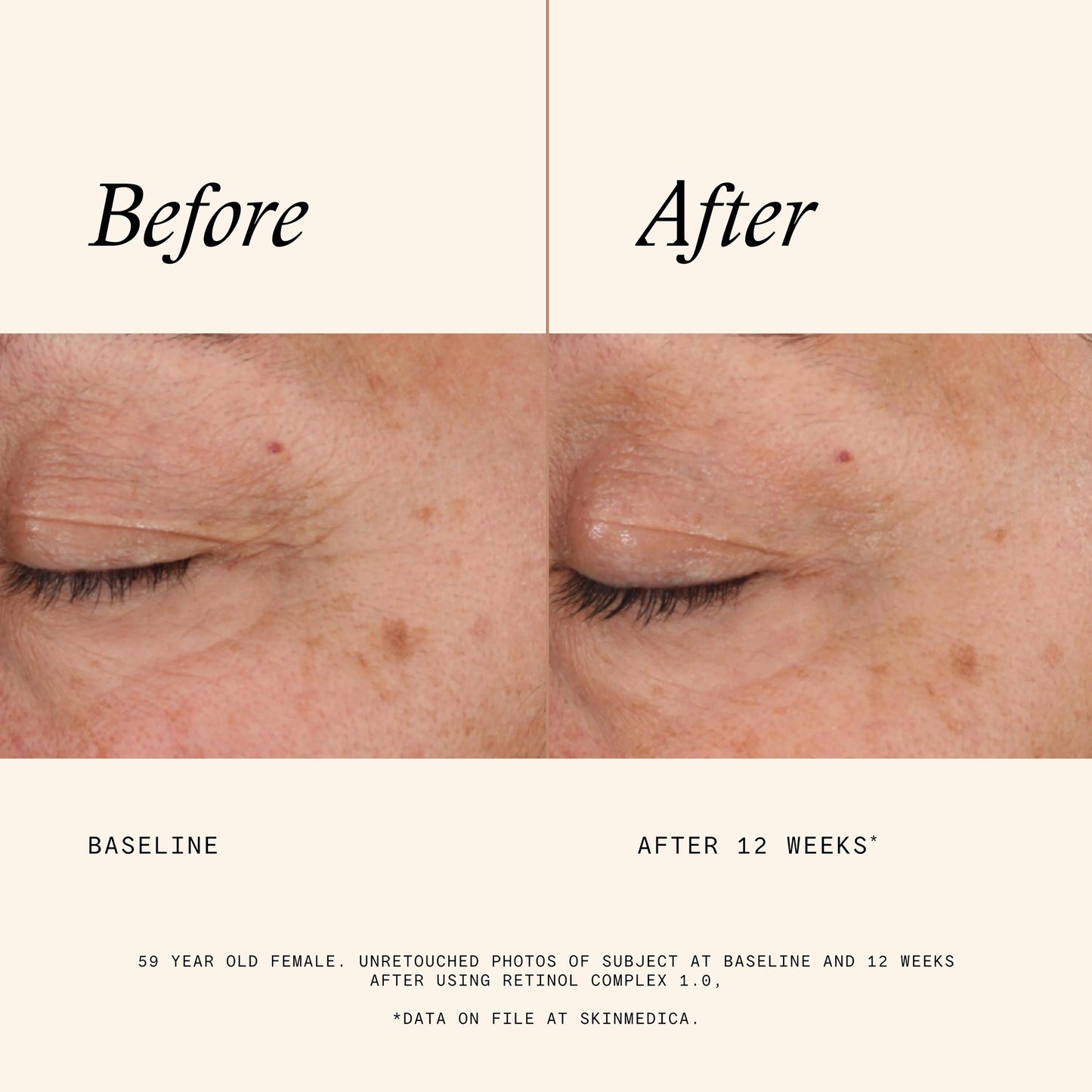Retinol Complex 1.0