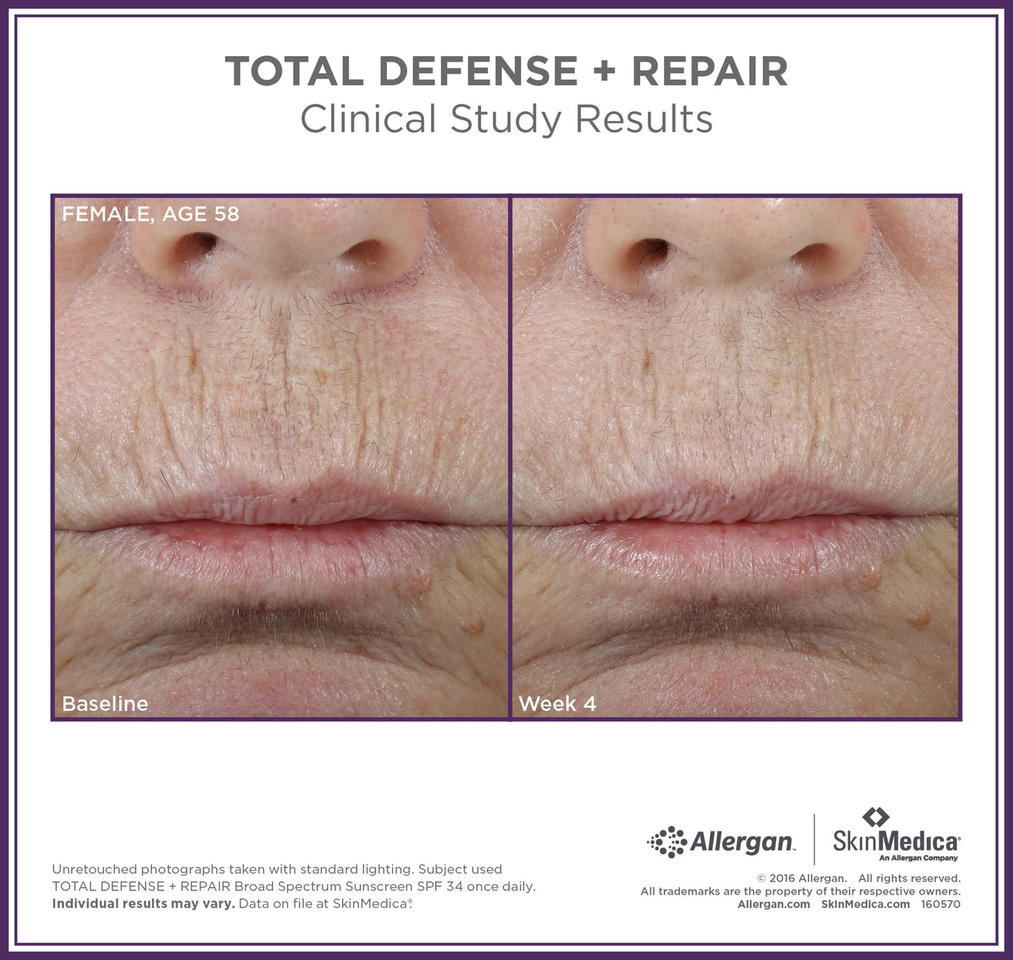 Total Defense Plus Repair Spf 34 Sunscreen