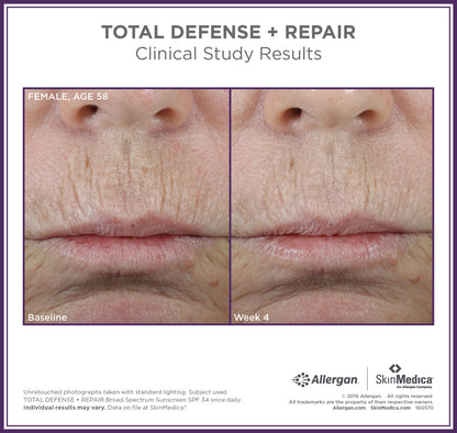 Total Defense Plus Repair Spf 34 Sunscreen