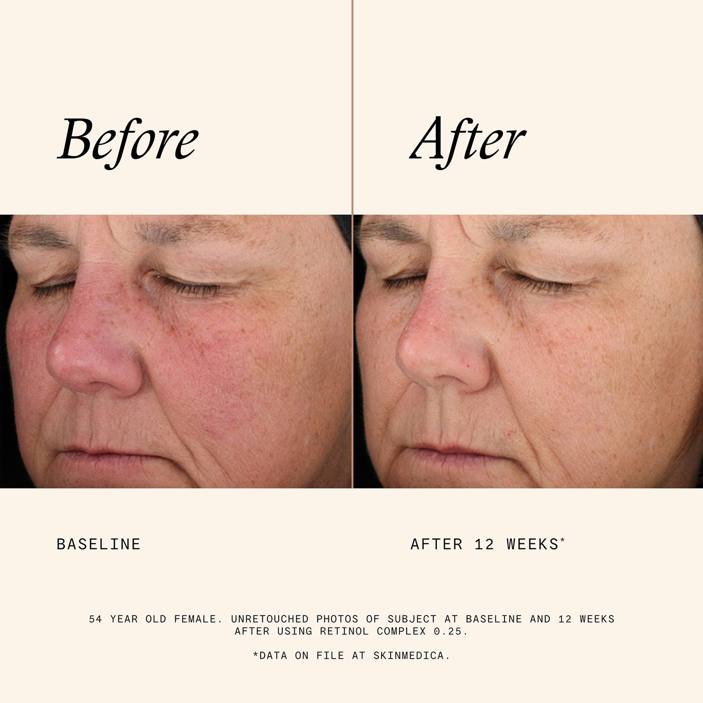 Retinol Complex 0.25