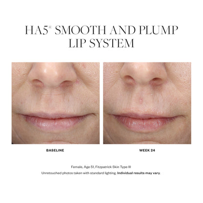 Ha5 Smooth & Plump Lip System