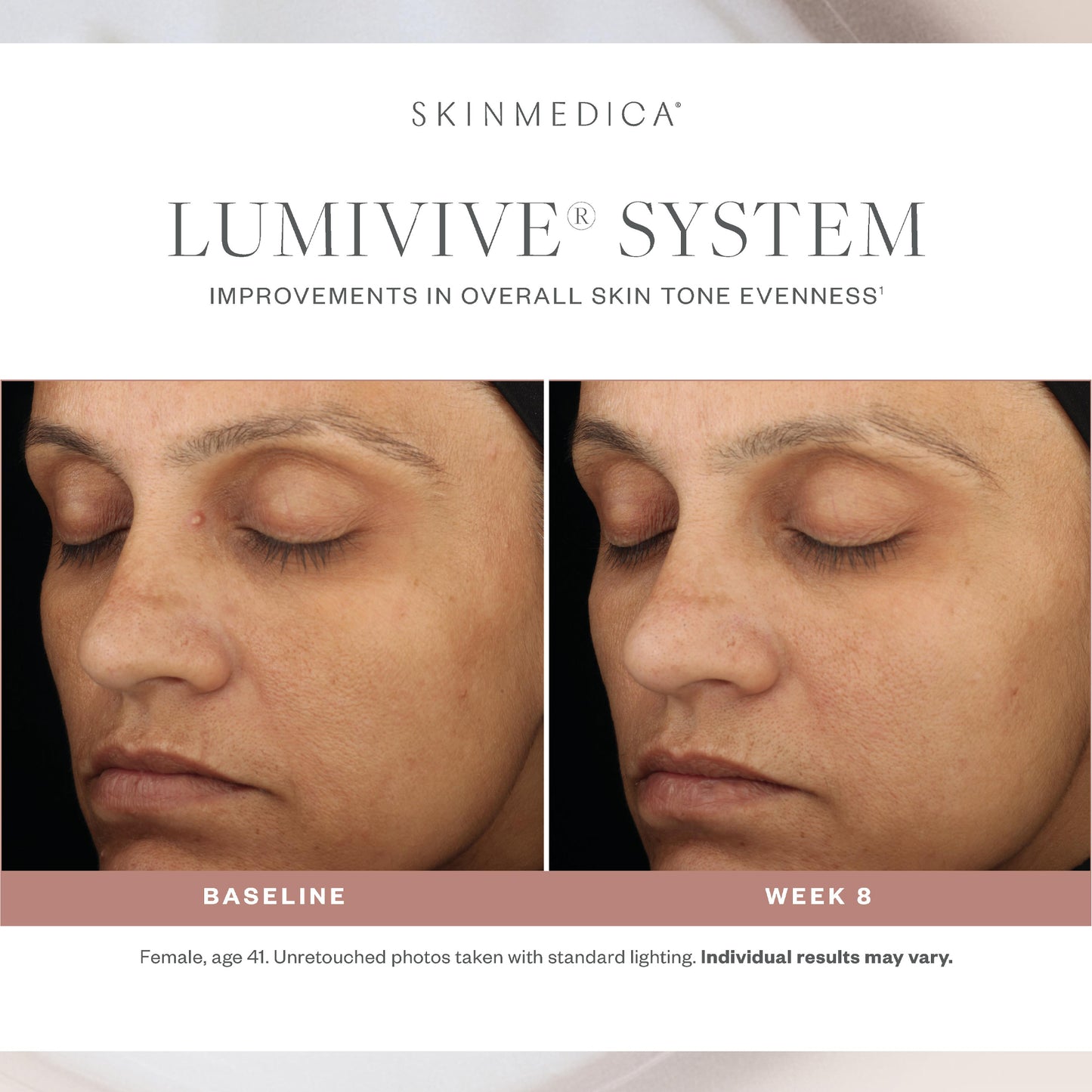 Lumivive System