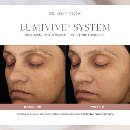 Lumivive System