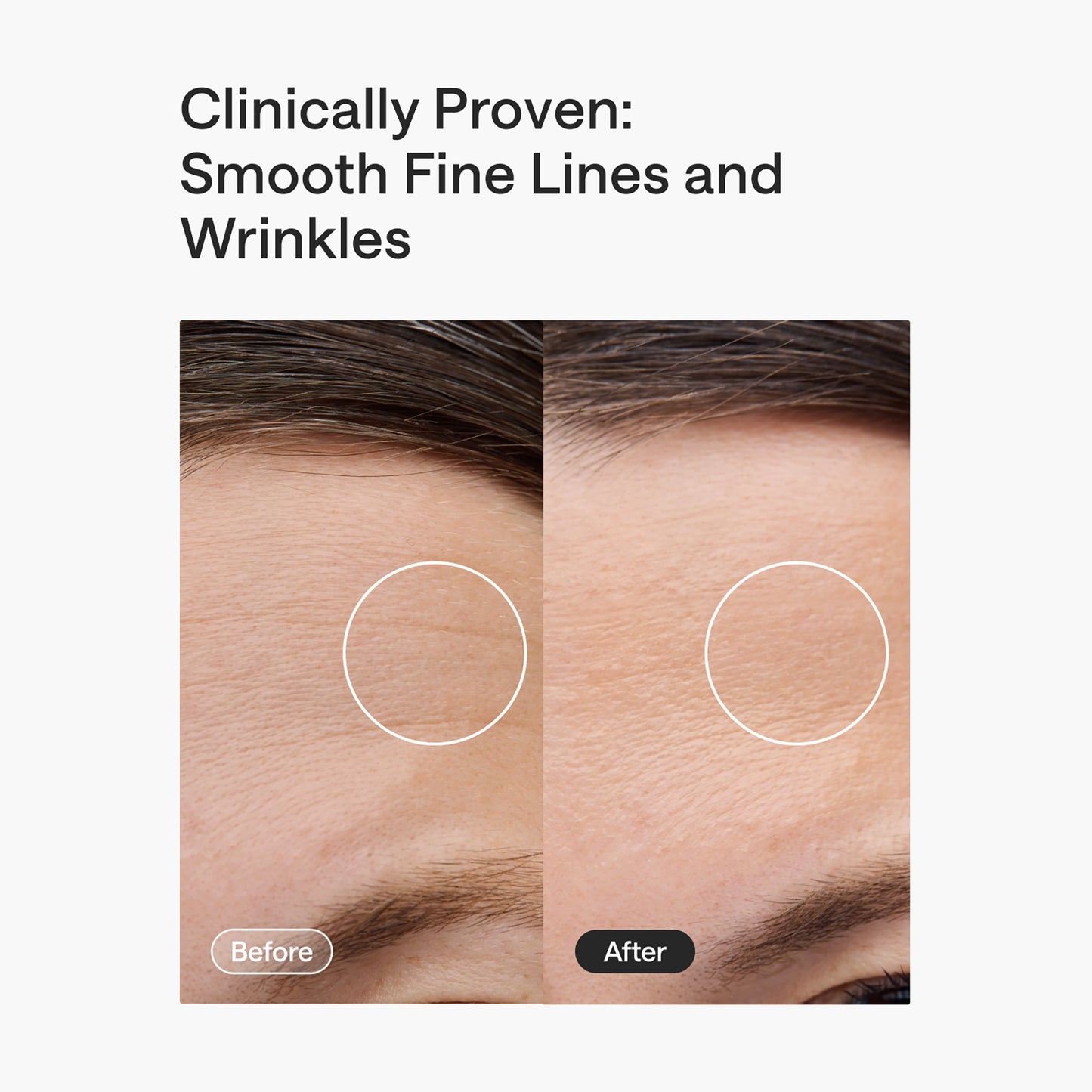 ReGlow LED Light Therapy Mask