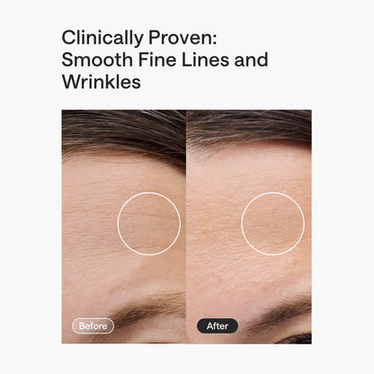 ReGlow LED Light Therapy Mask