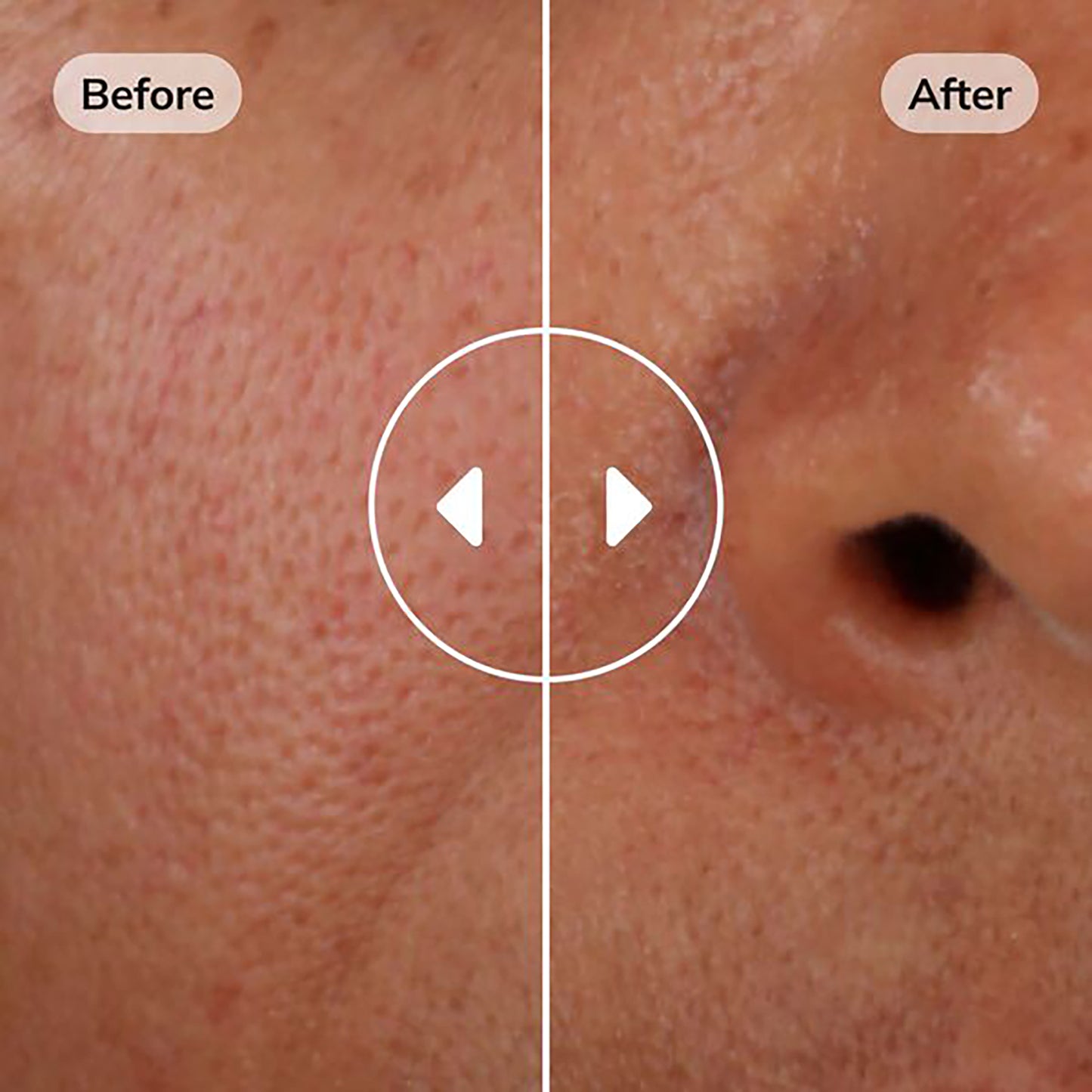 ISDINCEUTICS Hyaluronic Concentrate 30 ml