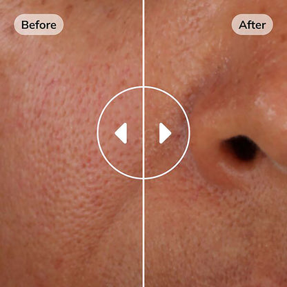 ISDINCEUTICS Hyaluronic Concentrate 30 ml