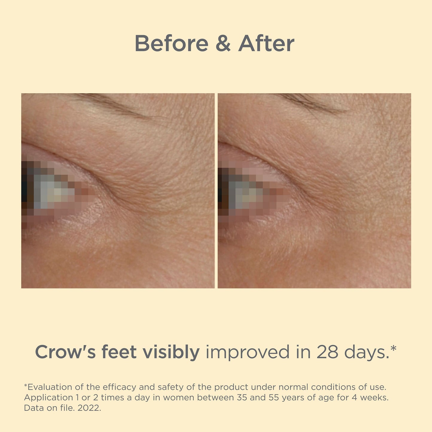 ISDINCEUTICS Vital Eyes