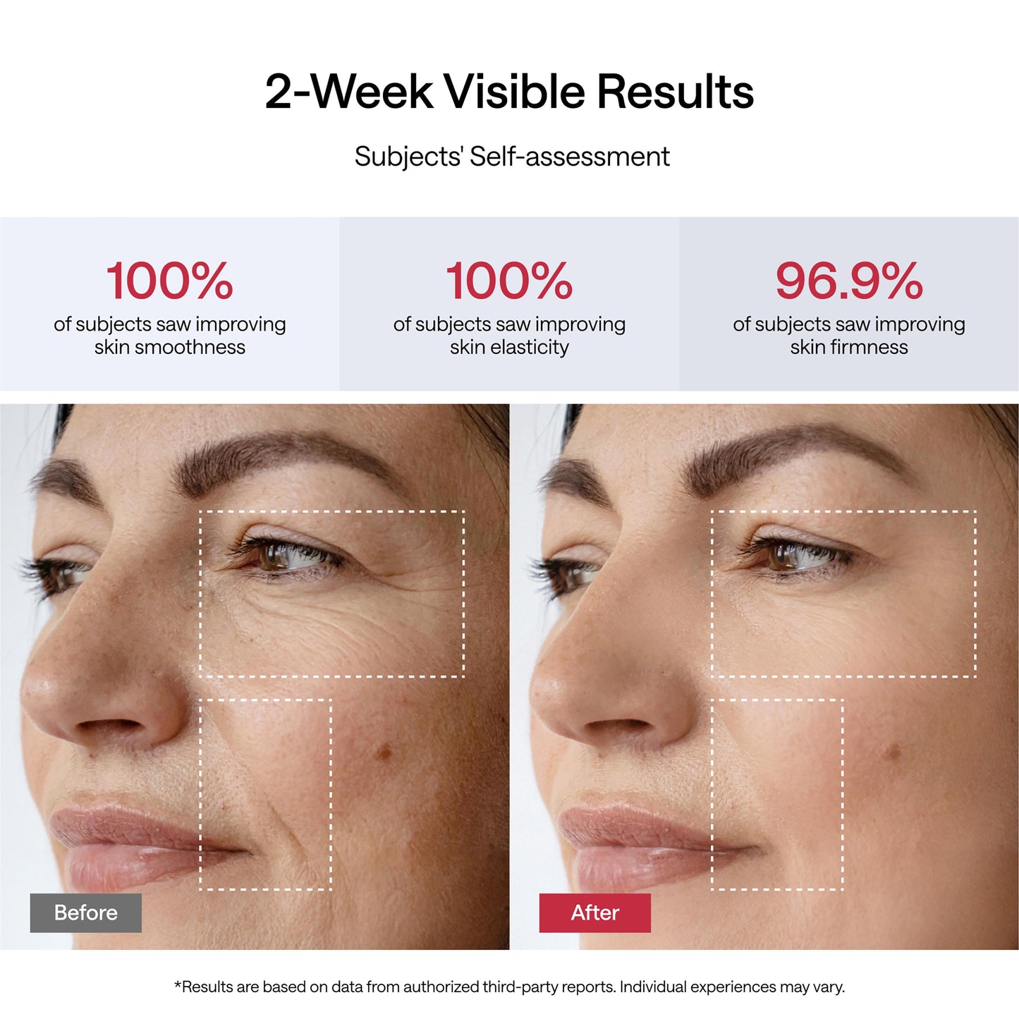 JMOON Ucollagen+ Basic Set