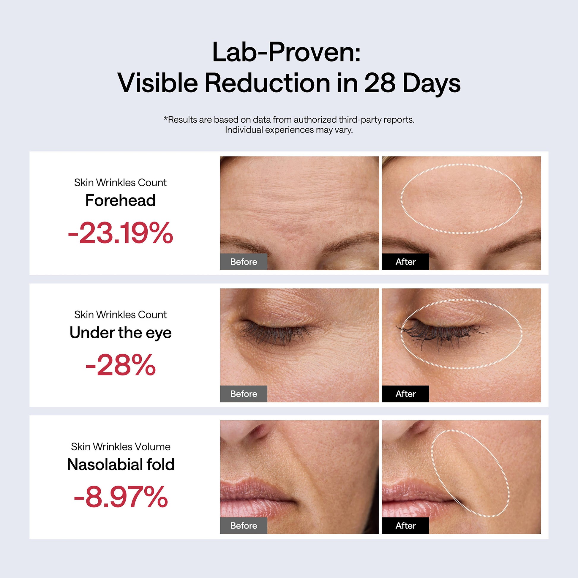 JMOON Ucollagen+ Basic Set