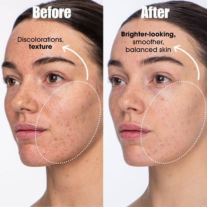 Detox Darling Balancing Essence Mist for Oily and Blemish-prone Skin