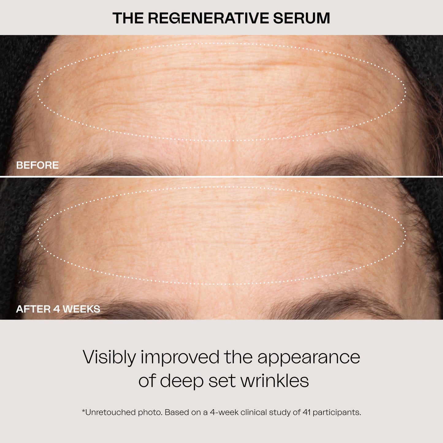 The Regenerative Serum Large