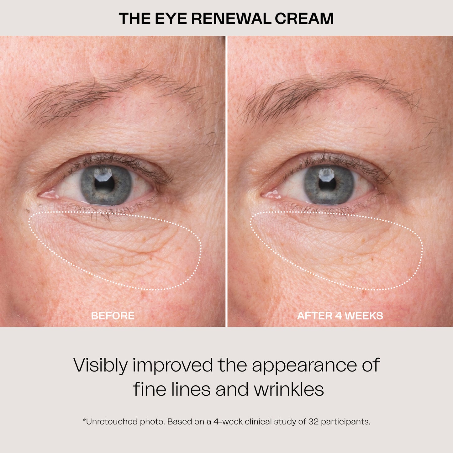 The Eye Renewal Cream