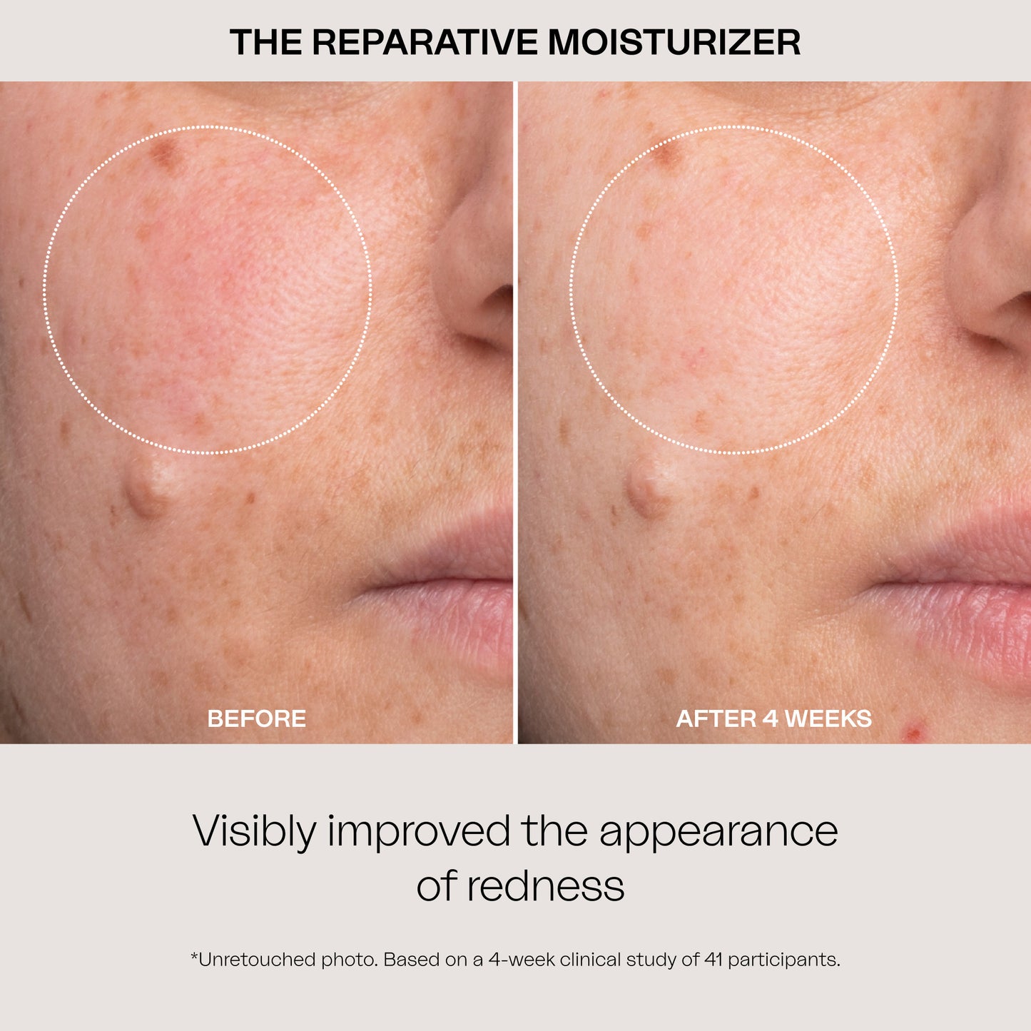 The Reparative Moisturizer