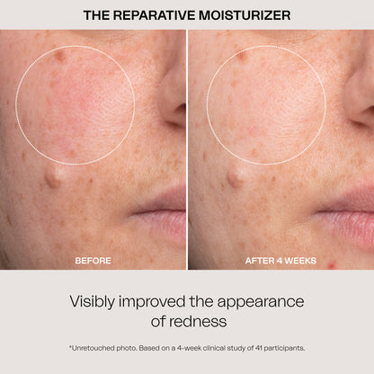 The Reparative Moisturizer