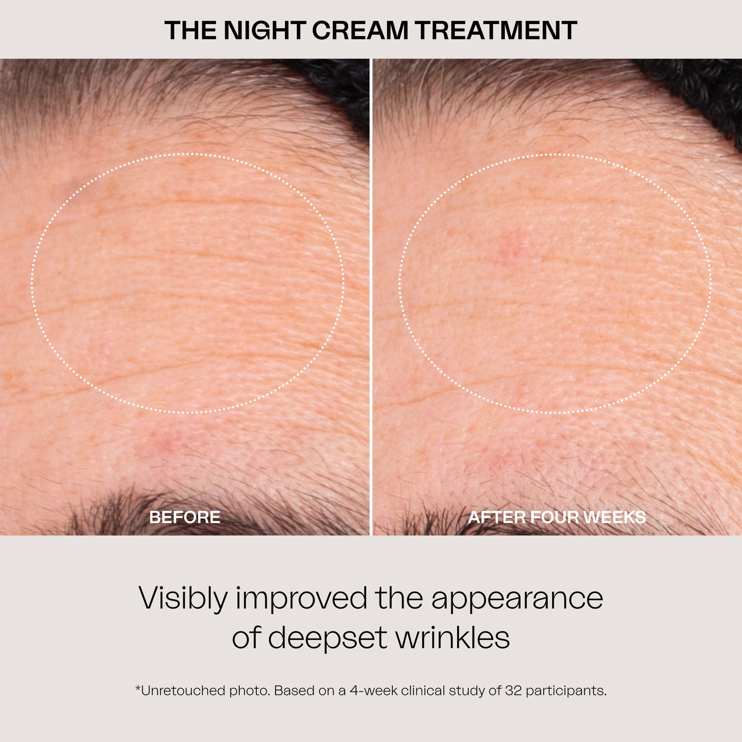 The Night Cream Treatment