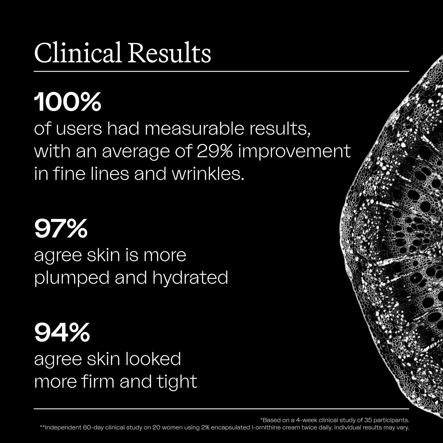 The Ultra-Rich Intensive Moisturizer