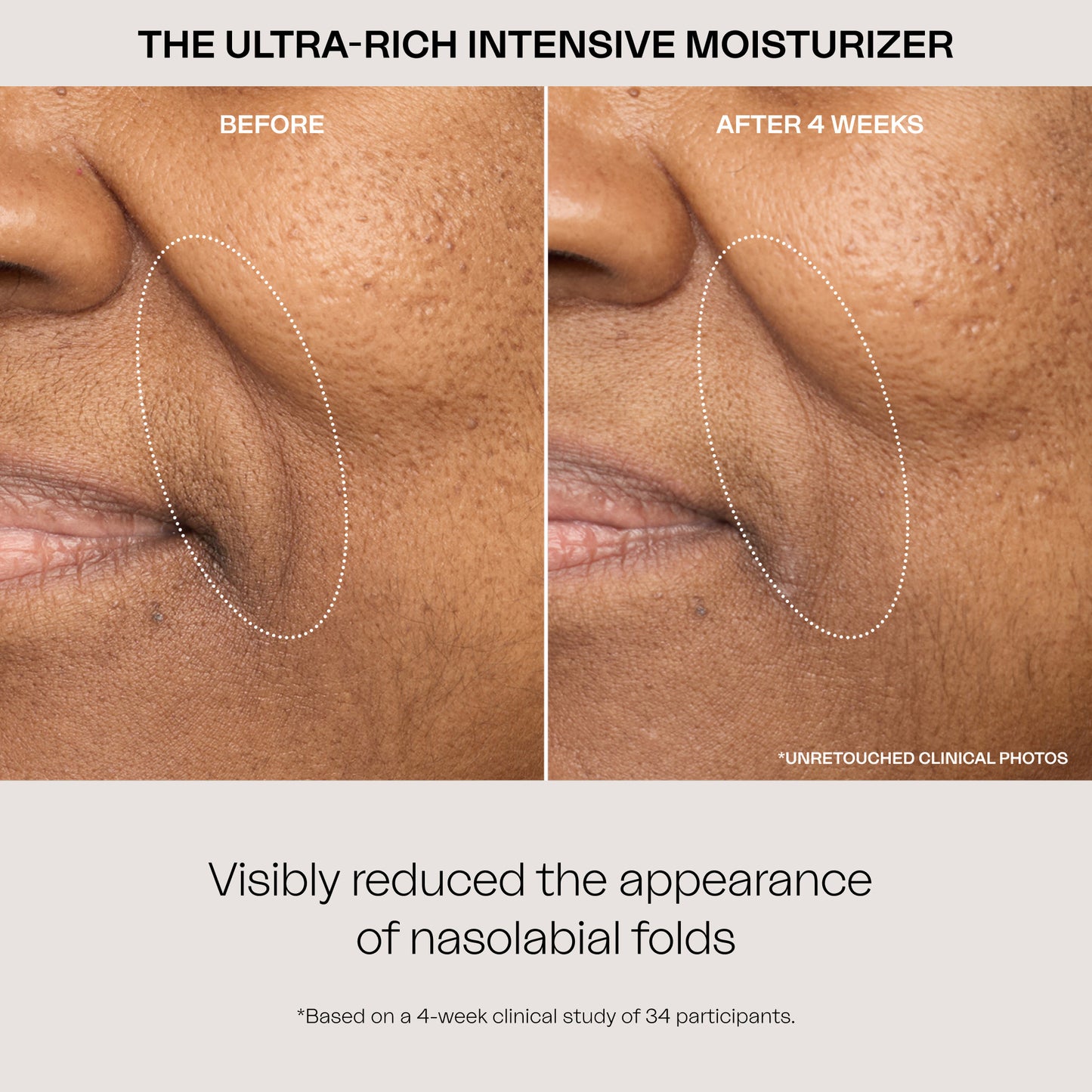 The Ultra-Rich Intensive Moisturizer