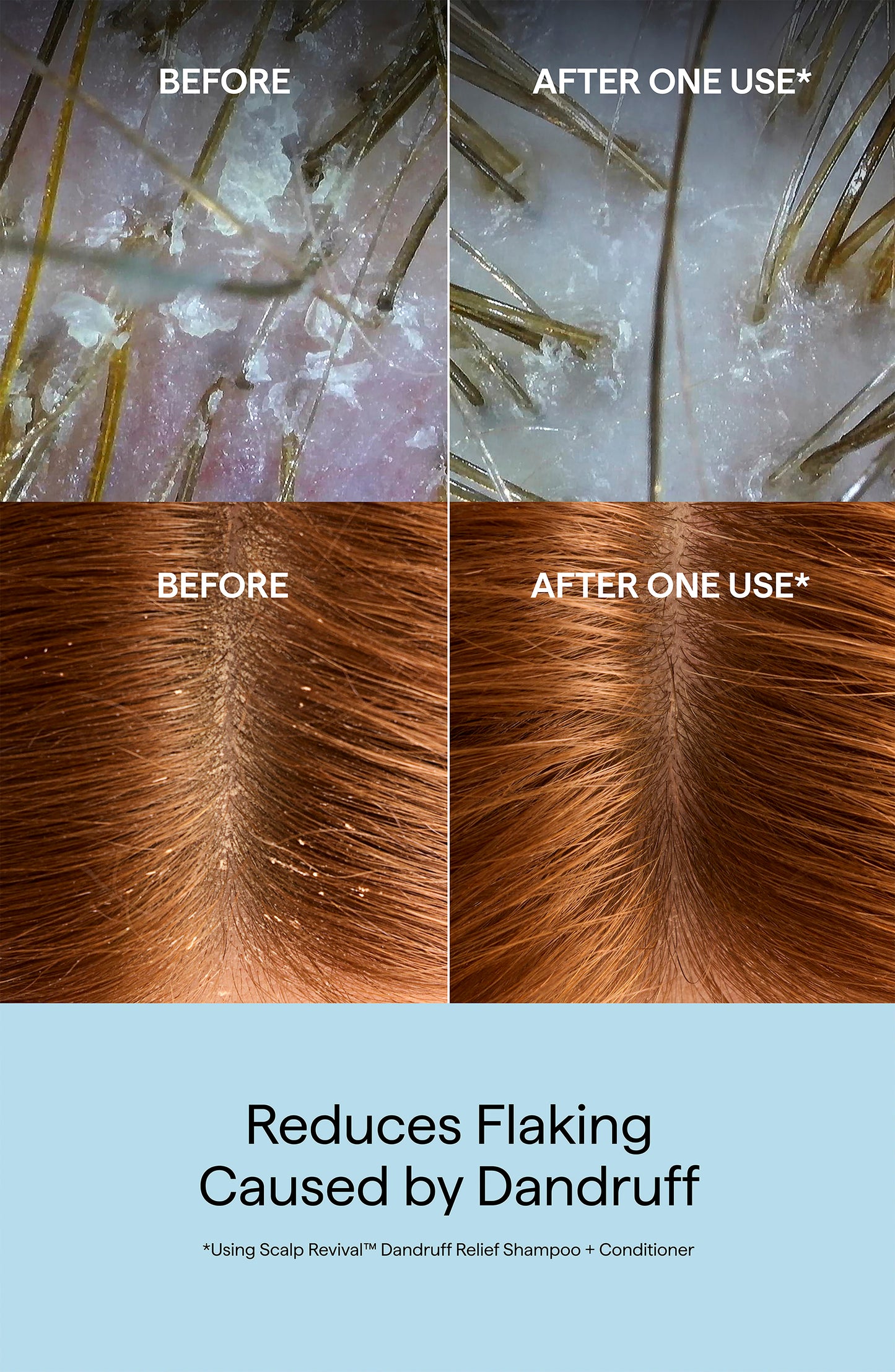 Scalp Revival Dandruff Relief Shampoo