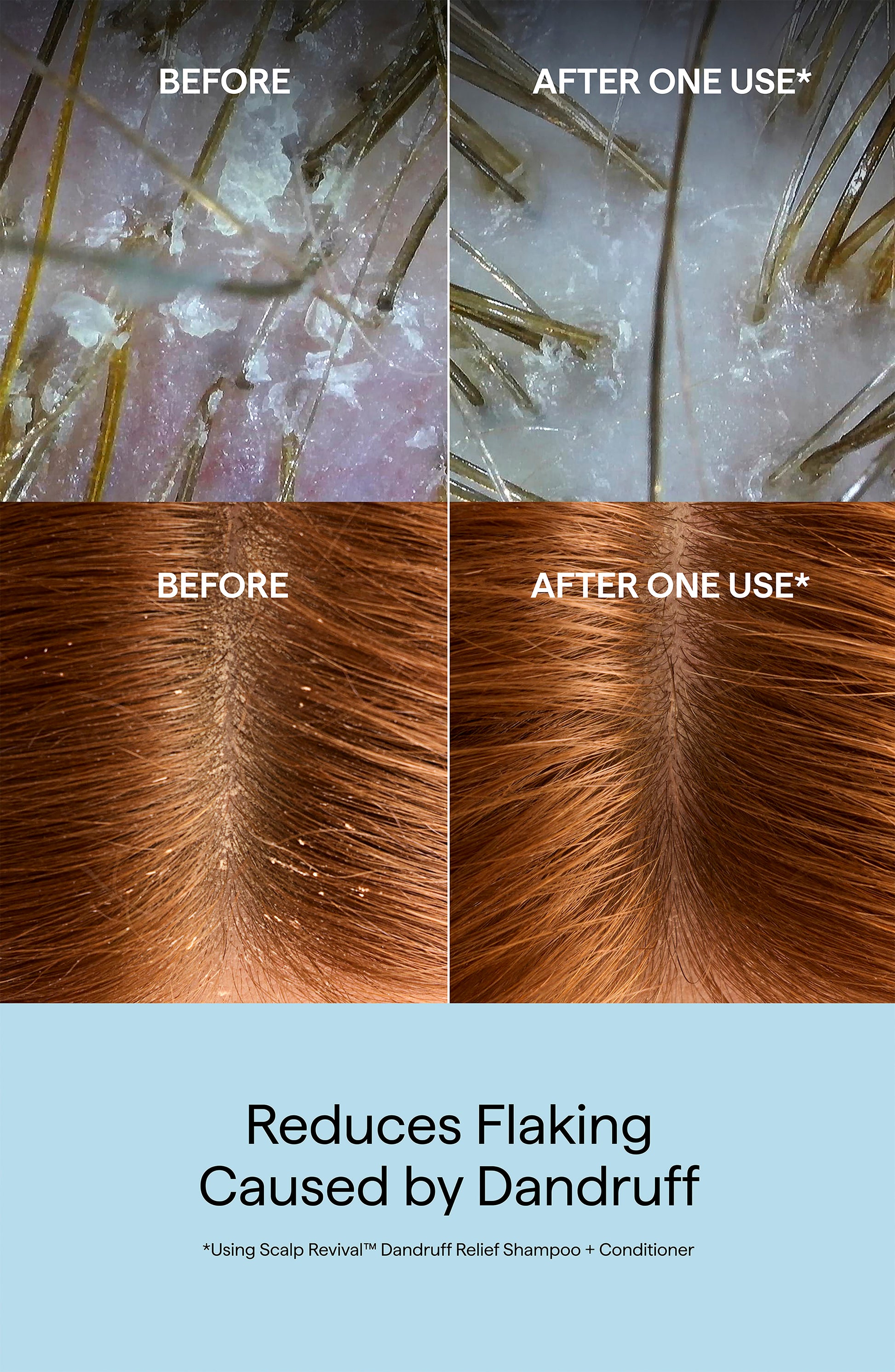 Scalp Revival Dandruff Relief Shampoo
