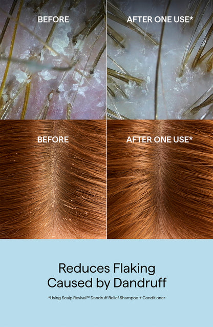 Scalp Revival Dandruff Relief Conditioner