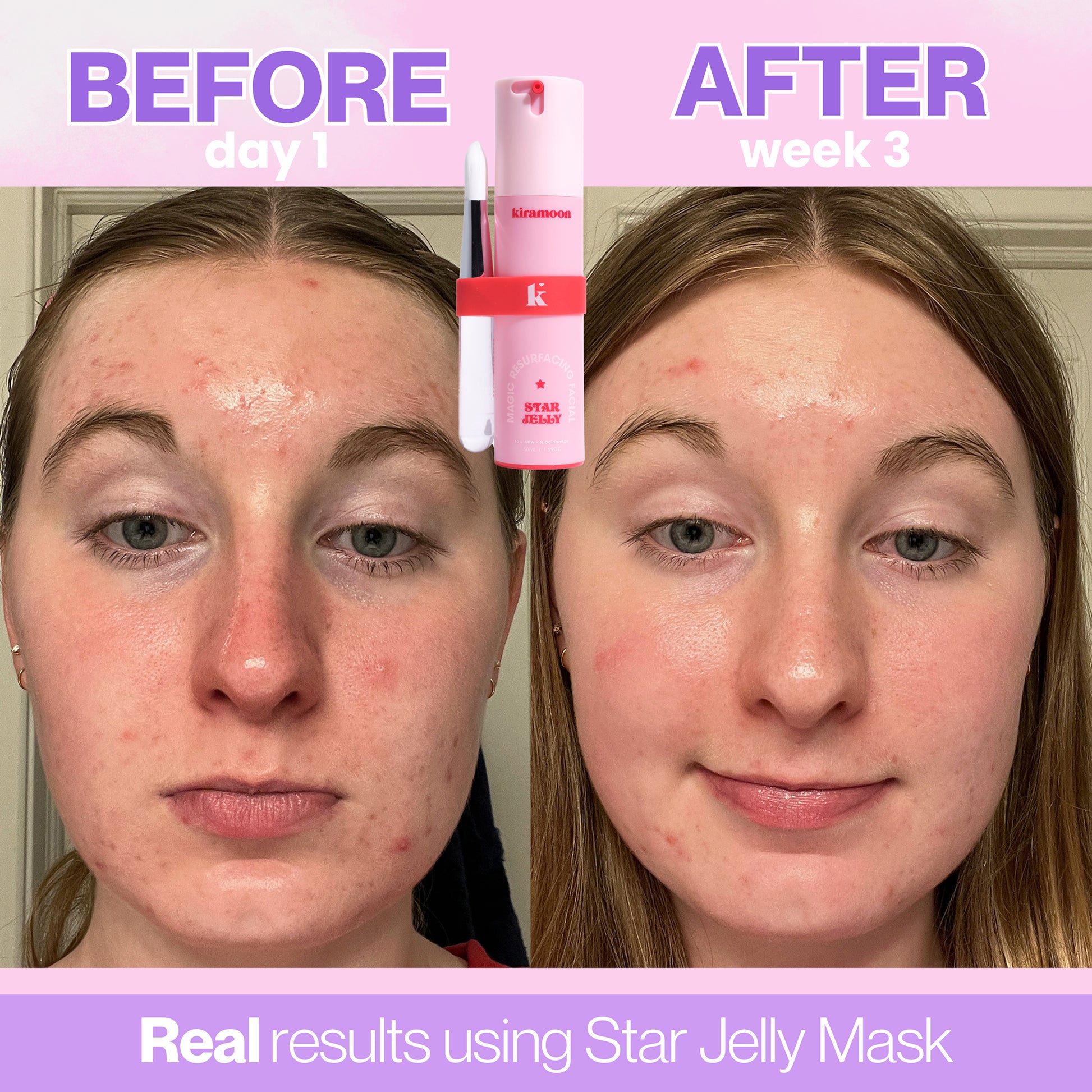 Star Jelly 10% Aha Exfoliating Mask